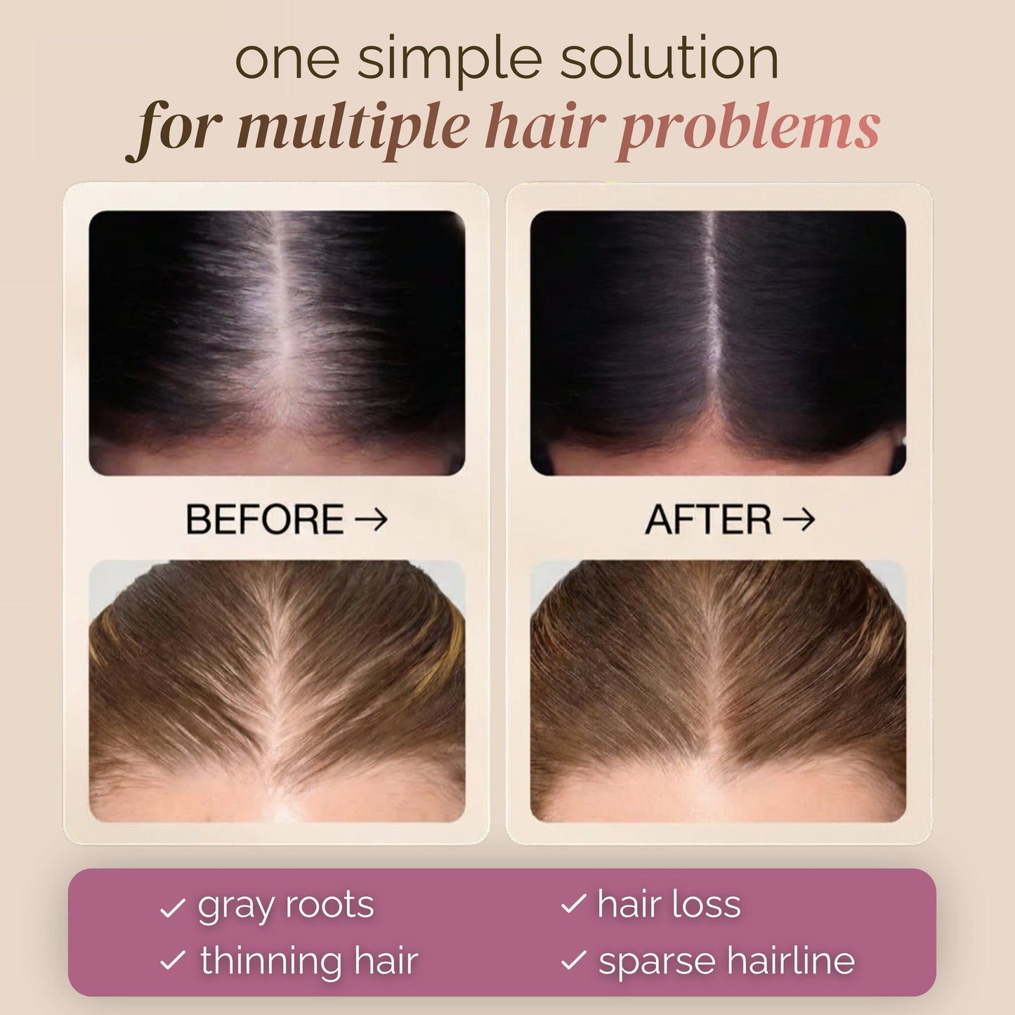 shape tape dab & go hair concealer